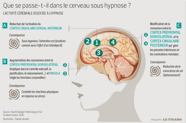 Schéma effet hypnose sur le cerveau